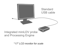 Integrated miniLDV System